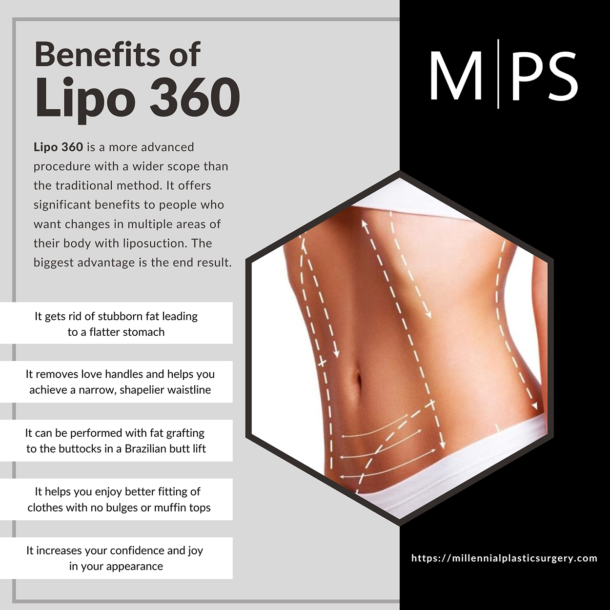 Benefits of Lipo 360 banner