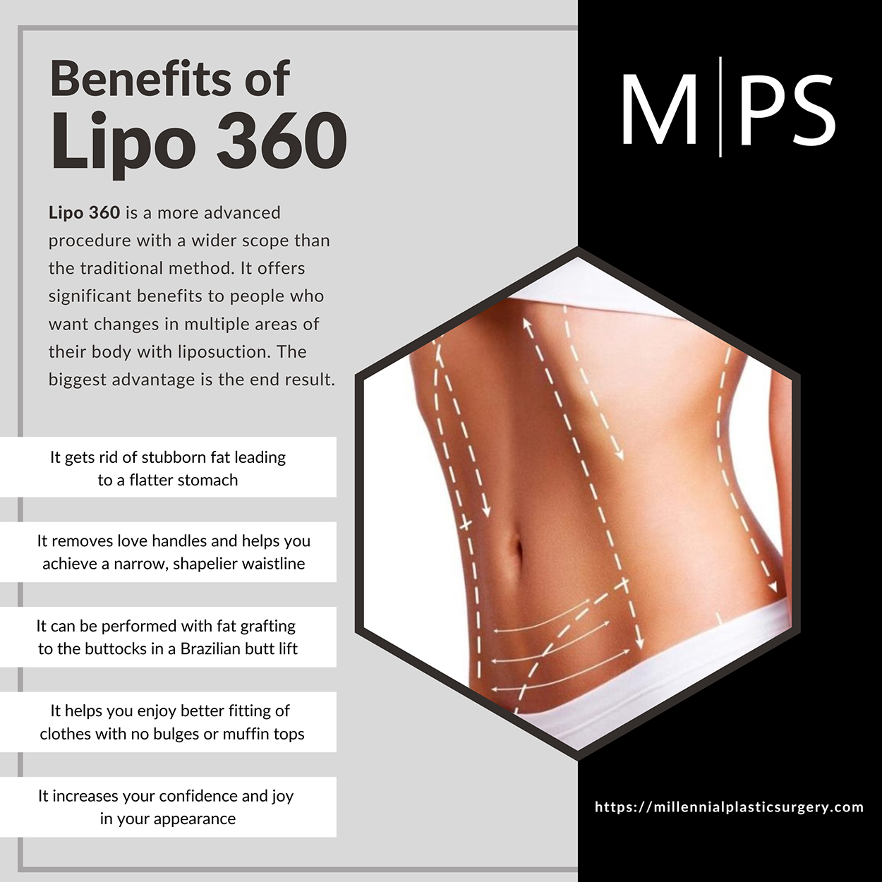 Waistline Reshaping With Muffin Top Liposuction - Explore Plastic Surgery