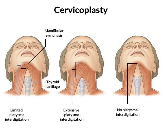 Tighten loose skin on neck & face, Men's aesthetics