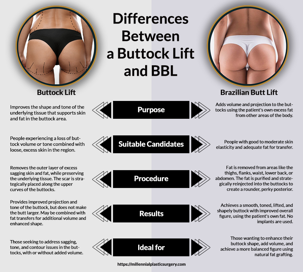 Difference Between a Buttock Lift and BBL