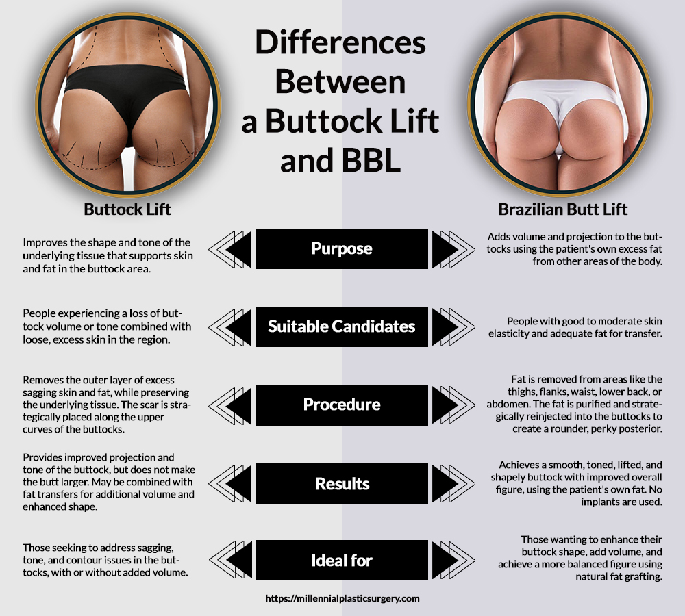 Why Do People Get A Brazilian Butt Lift?