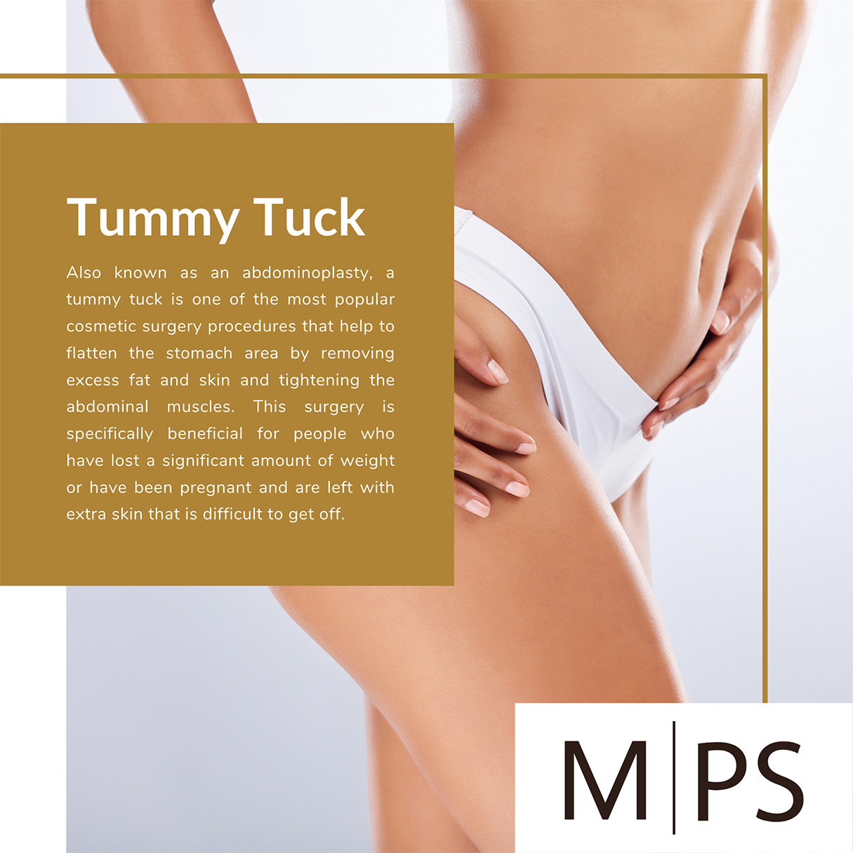 The Timeline of a Tummy Tuck Recovery - Millennial Plastic Surgery