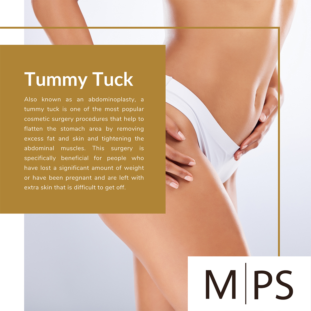 Tips for Maintaining Your Flat Stomach After a Tummy Tuck