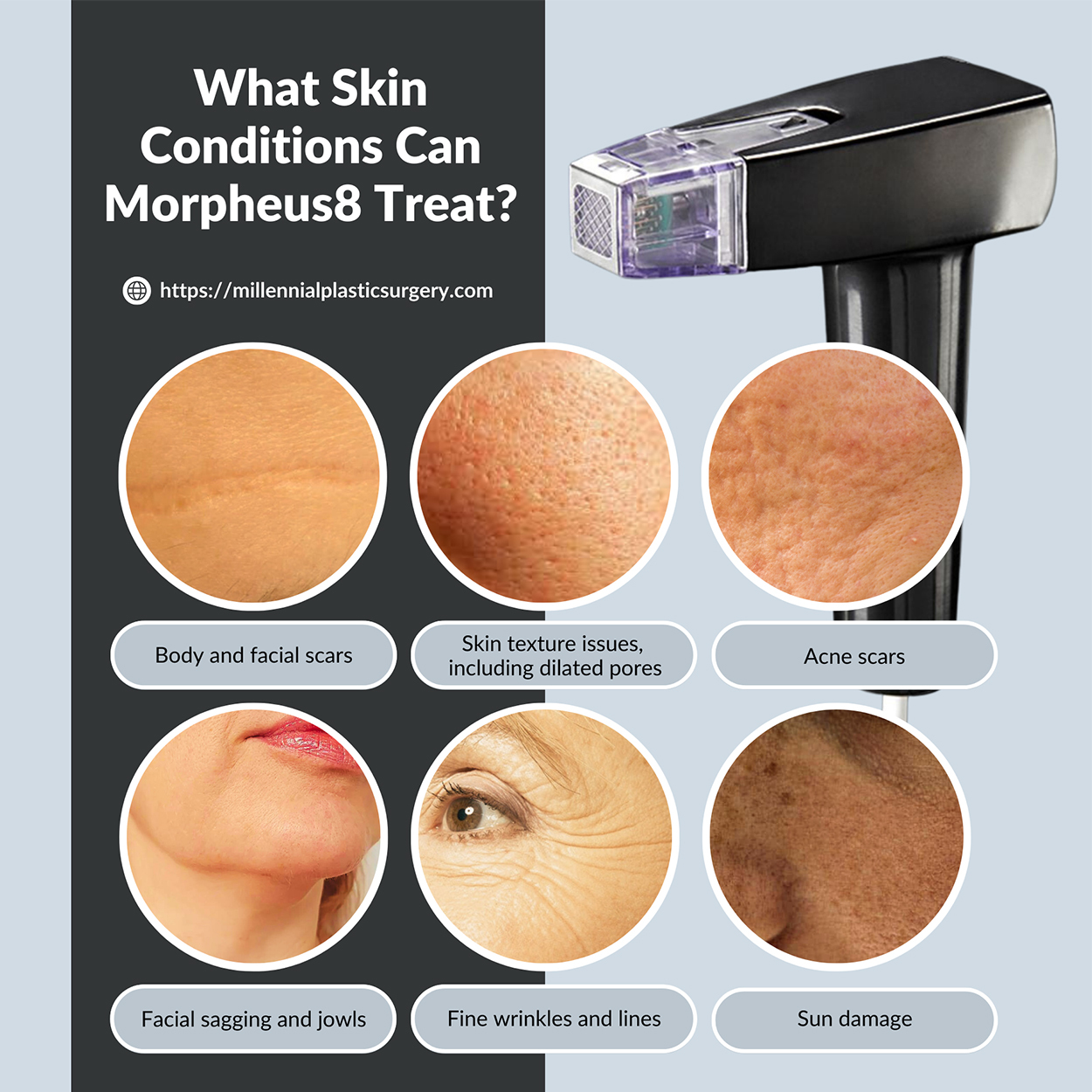 What Skin Conditions Can Morpheus8 Treat banner