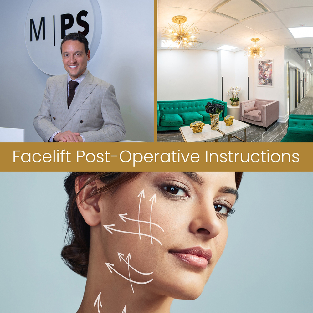 Facelift Recovery Guide PostOperative Instructions for a Successful Transformation