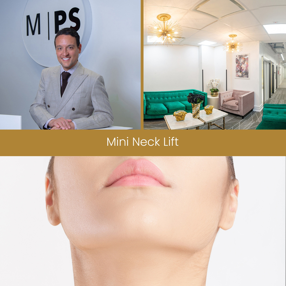 Mini neck lift cost near me