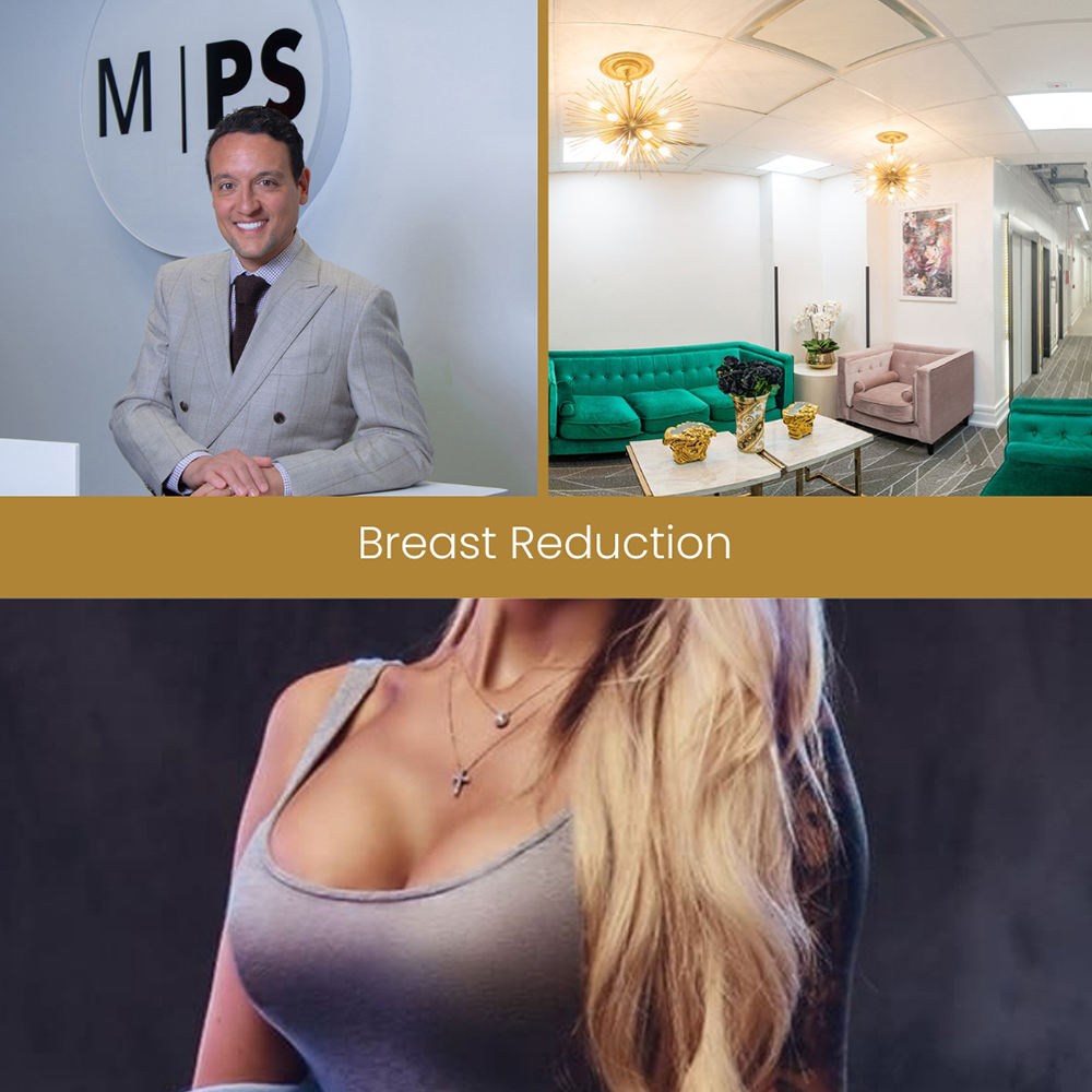 Dr. David Shokrian breast lift and breast reduction surgeon