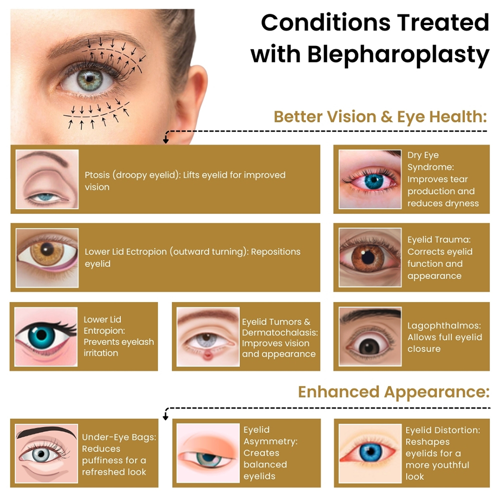 Conditions Treated with Blepharoplasty