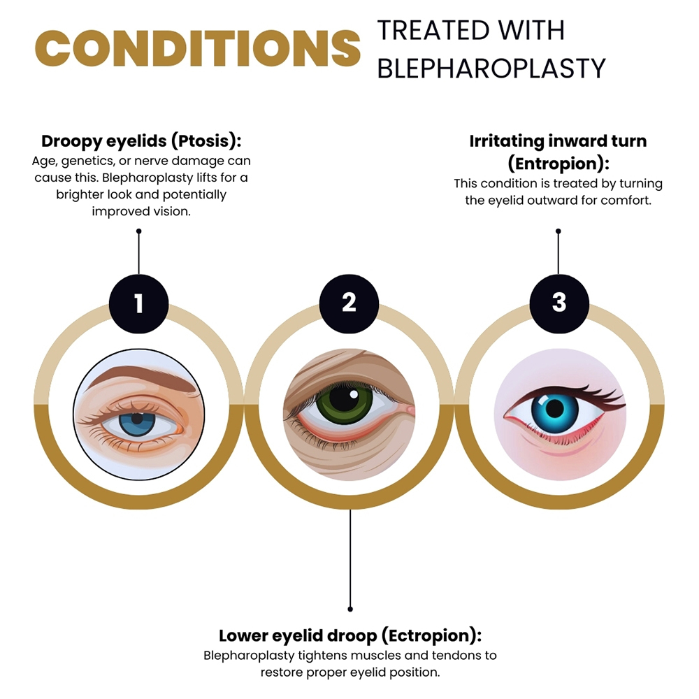 Conditions Treated with Blepharoplasty