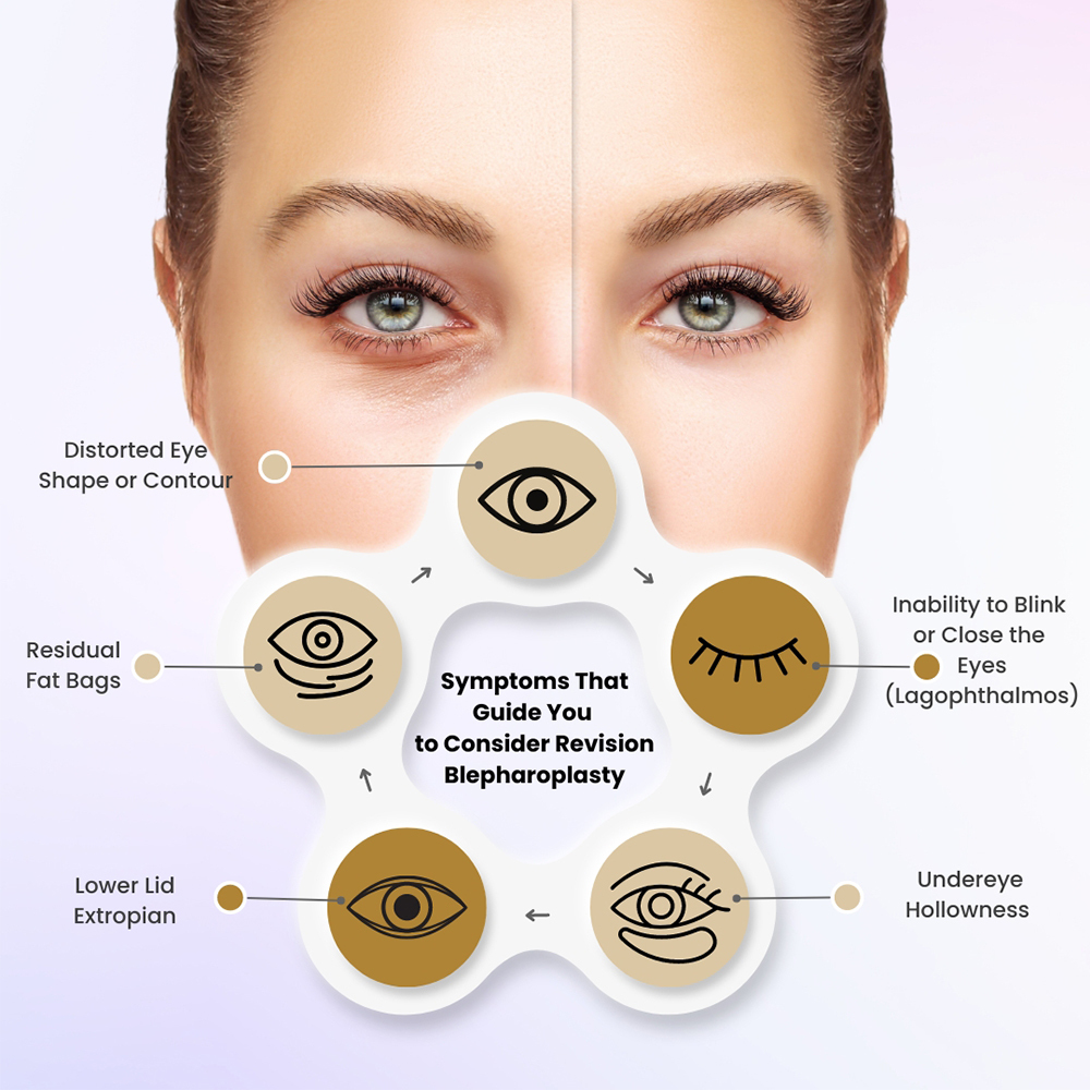 Symptoms that guide you to consider revision blepharoplasty