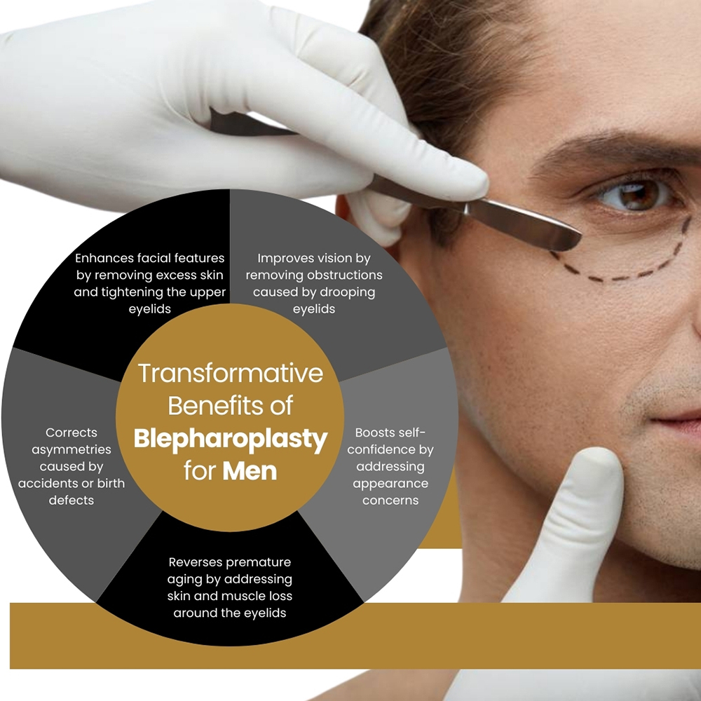 Transformative Benefits of Blepharoplasty for Men