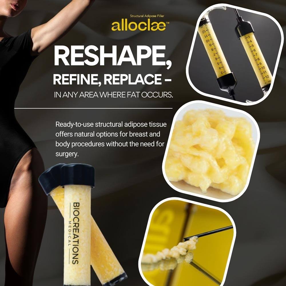 Alloclae Filler in New York