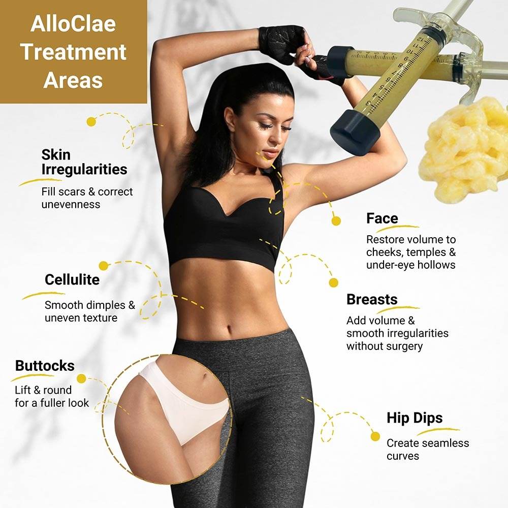 Alloclae Treatment Areas