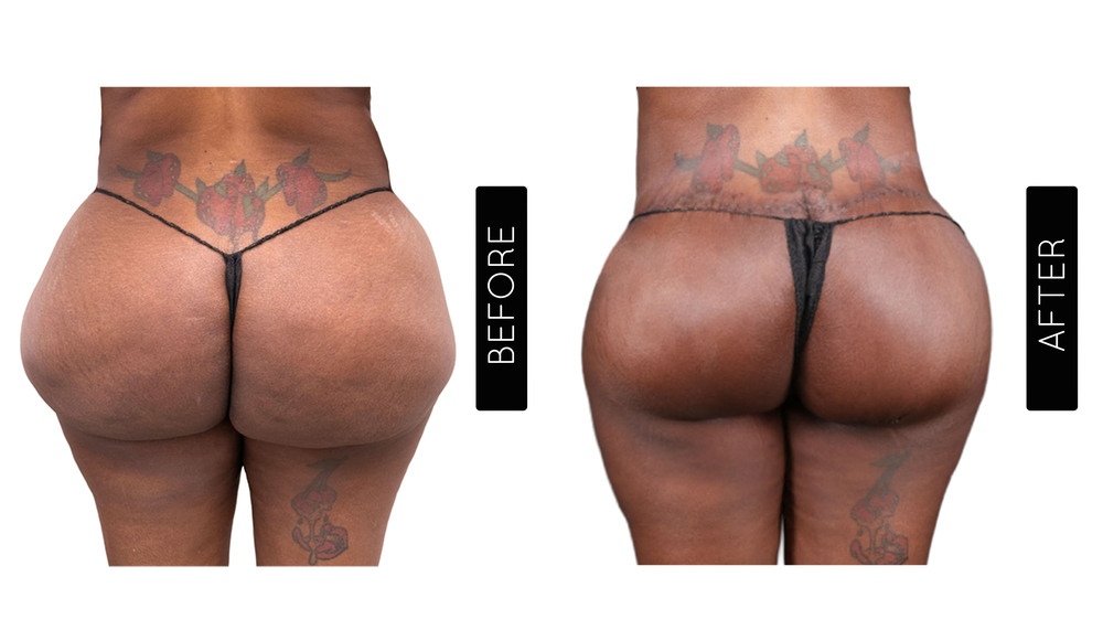 Biopolymer Removal Before & After