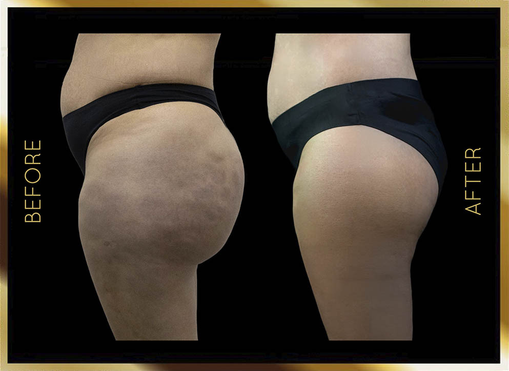 Biopolymer Removal Before and After NYC Case-1 Side