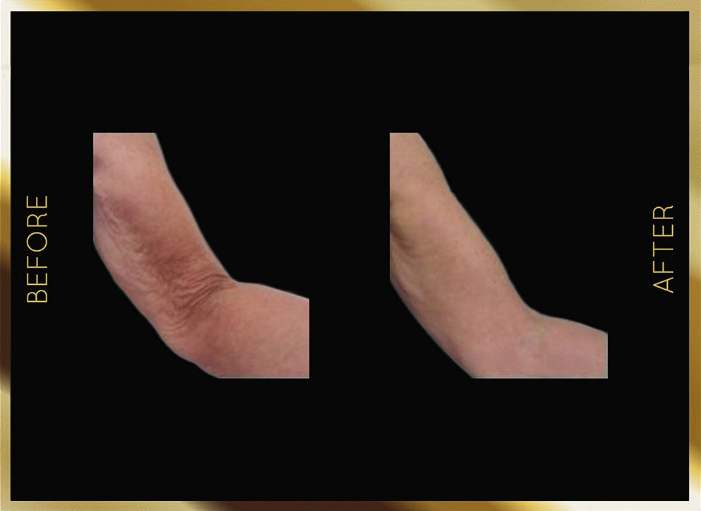 Evolve Before & After NYC Case-1