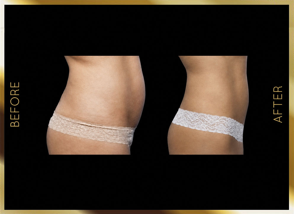 Evolve Before & After NYC Case-3